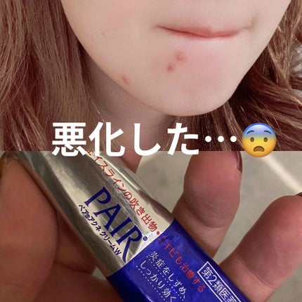 ドルマイシン軟膏(医薬品)/ゼリア新薬工業/その他を使ったクチコミ(2枚目)