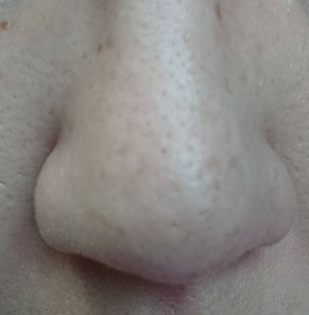 マイクラランス ブラ—&マット スティック/CLARINS/化粧下地を使ったクチコミ(2枚目)