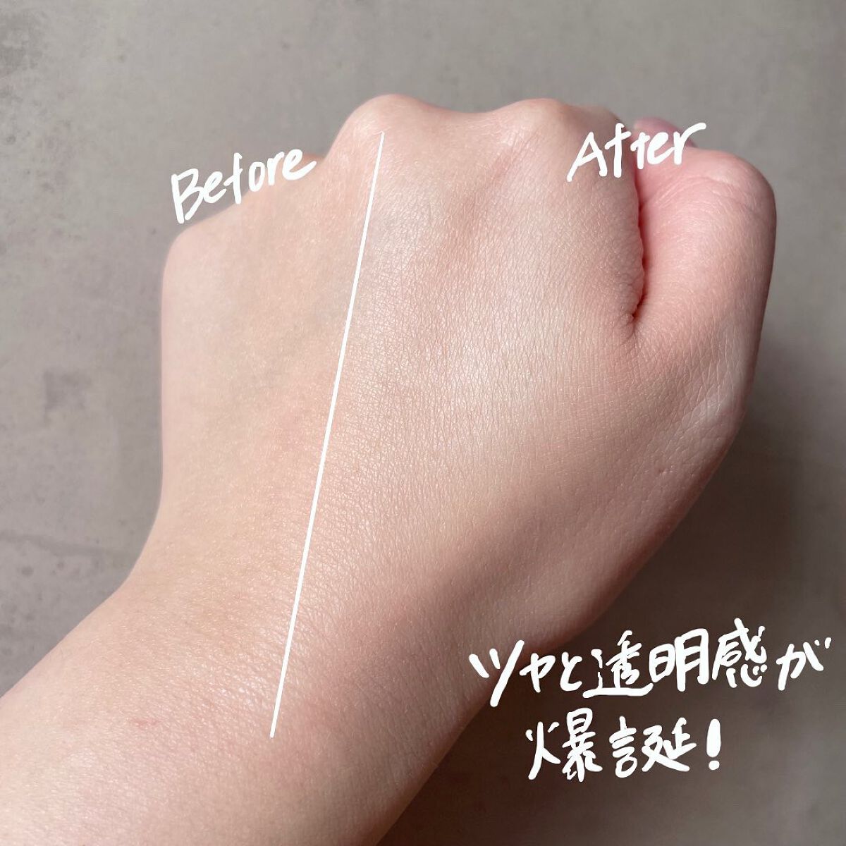 モイスチュアコート ジェル/COVERMARK/ルースパウダーを使ったクチコミ(5枚目)