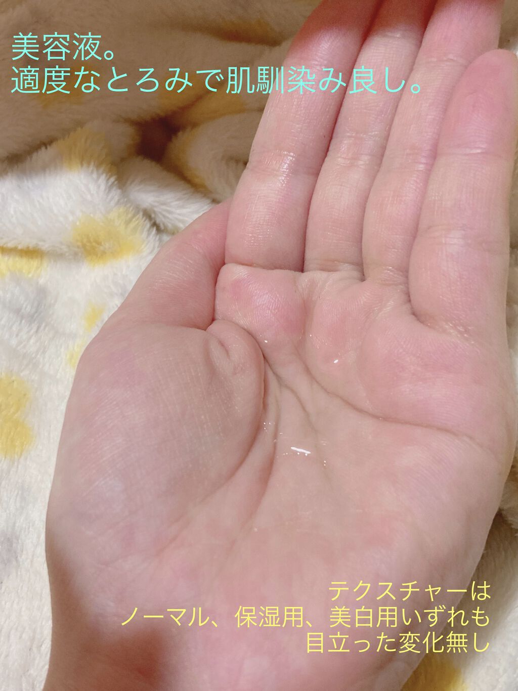 米ぬか美人NS-K 化粧水 しっとりタイプ/米ぬか美人 NS-K/化粧水を使ったクチコミ（3枚目）