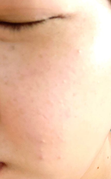 チェリーブロッサム ウォータークッション/CORINGCO/クッションファンデーションを使ったクチコミ(4枚目)