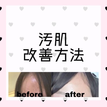 DHC はとむぎエキス/DHC/健康サプリメントを使ったクチコミ(1枚目)