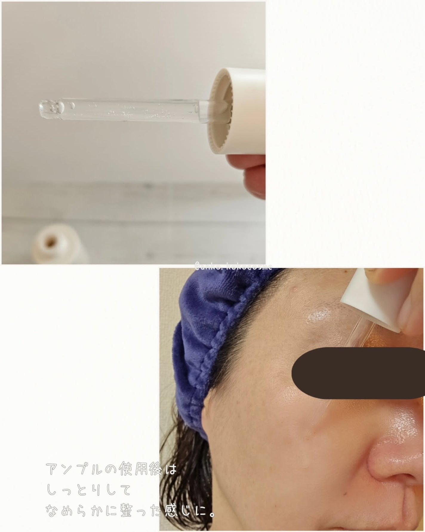 ドクダミテンダーゾームダブルカーミング水分アンプル/ilso/美容液を使ったクチコミ(4枚目)