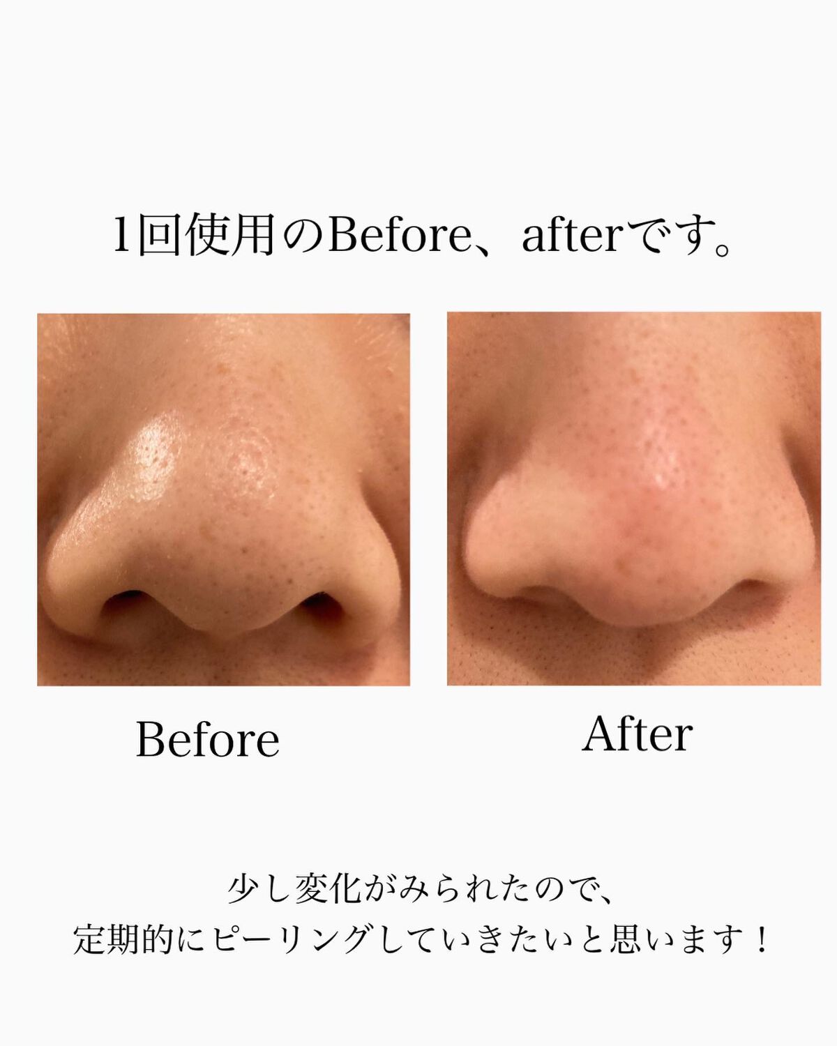 コスメジタン 薬用美白ハナビジン/シーヴァ/スクラブ・ゴマージュを使ったクチコミ(4枚目)