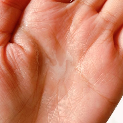 ベタールート ダンドラフ ヘアトニック/Daleaf/頭皮ローションを使ったクチコミ(3枚目)