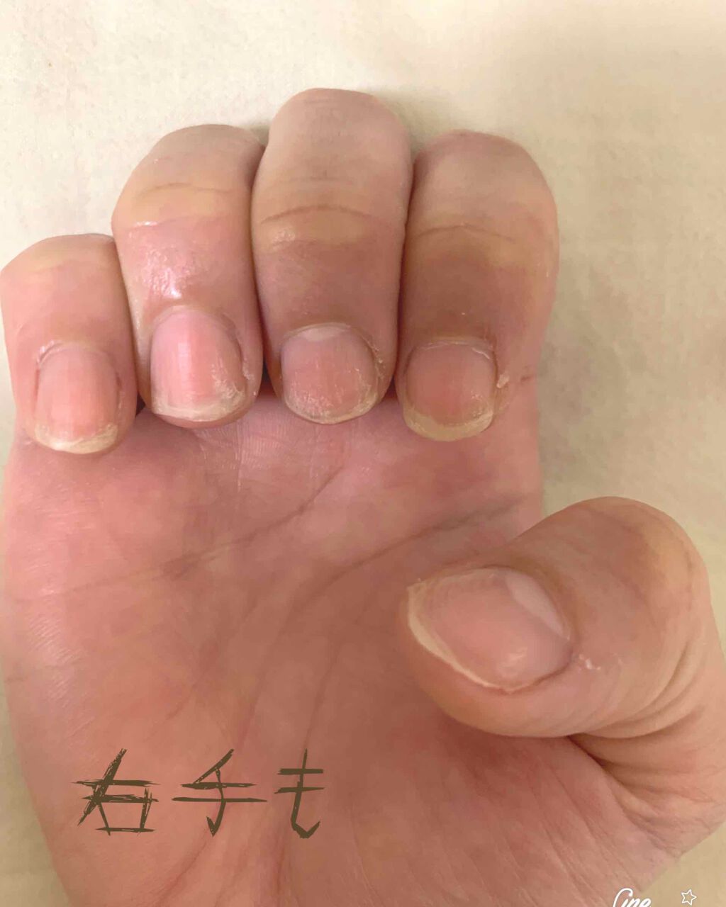 オーガニックビューティーオイルネイルフローラルシトラス/生活の木/ネイルオイル・トリートメントを使ったクチコミ(3枚目)