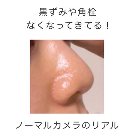 ブルーブライトピーリングパッド/EMROSÉ/トナーパッドを使ったクチコミ(2枚目)