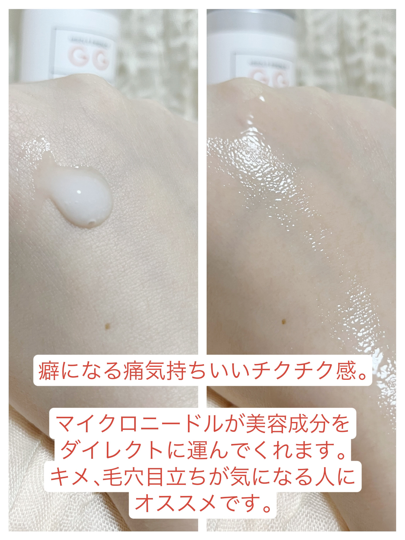 ビディ ニードルエッセンス GG/ビディ/美容液を使ったクチコミ（2枚目）