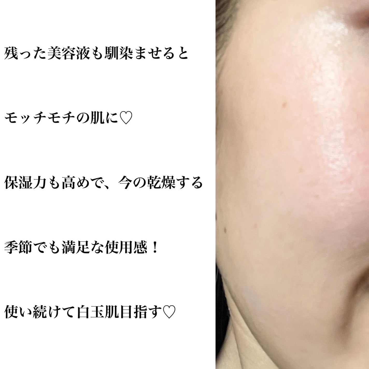 ルルルン ハイドラ EX マスク/ルルルン/シートマスク・パックを使ったクチコミ(5枚目)