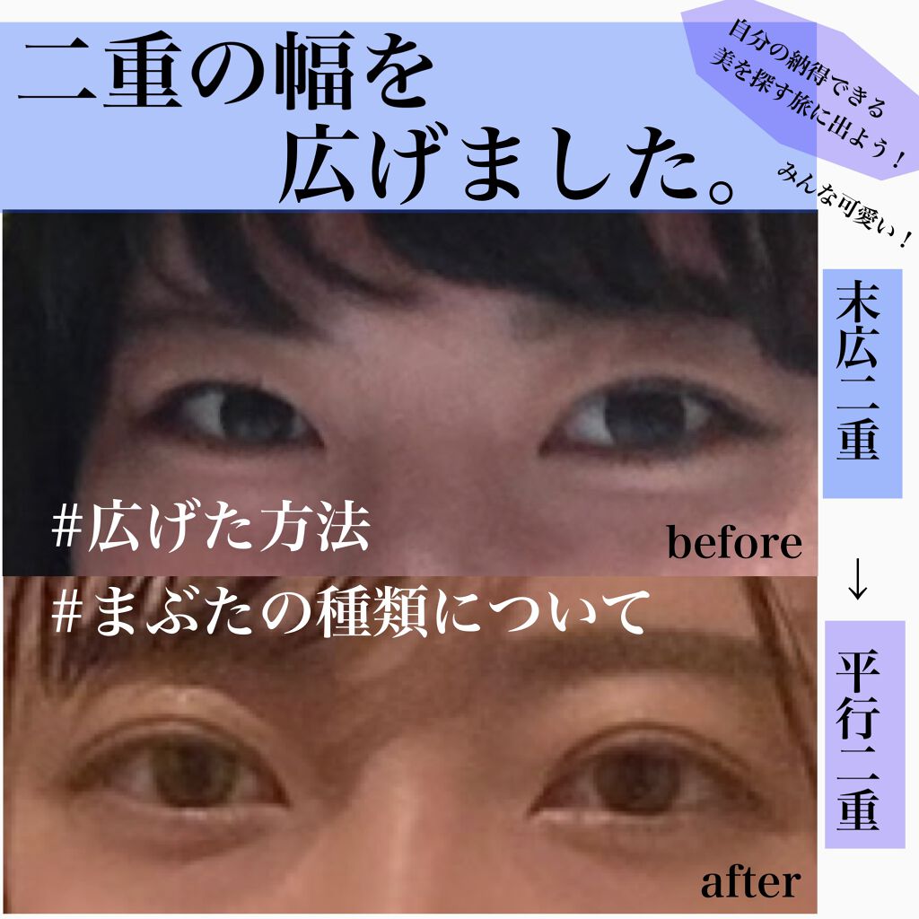 のびーるアイテープ（絆創膏タイプ、レギュラー）/DAISO/二重まぶた用アイテムを使ったクチコミ（1枚目）