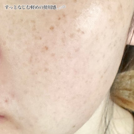 バクチオールAアンプル/23years old/美容液を使ったクチコミ(4枚目)