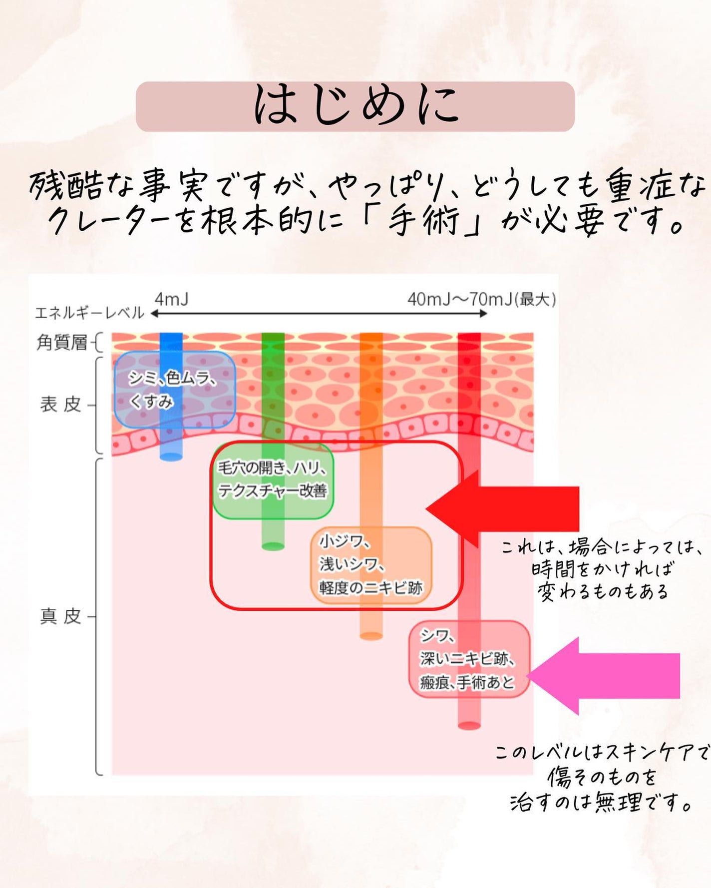 おゆみ|ニキビ・ニキビ跡ケア on LIPS 「@______ohyoume他の投稿はこちらから!【クレーター..」(2枚目)