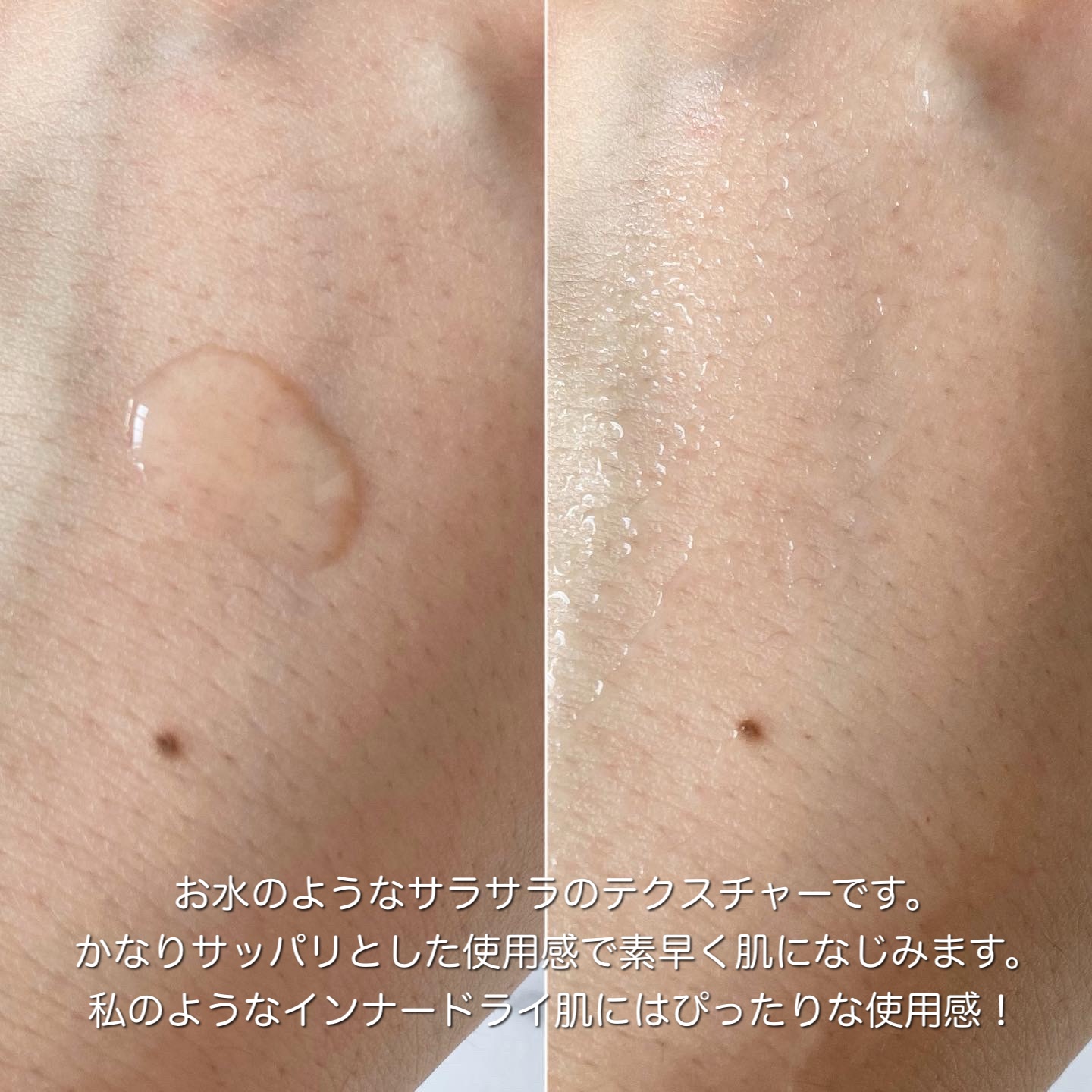 センテラ アンプル/SKIN1004/美容液を使ったクチコミ（2枚目）