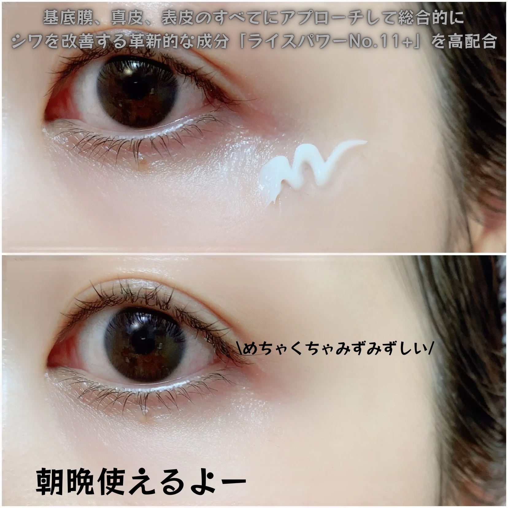 リンクルクロス 10g/RAIZ/美容液を使ったクチコミ（2枚目）