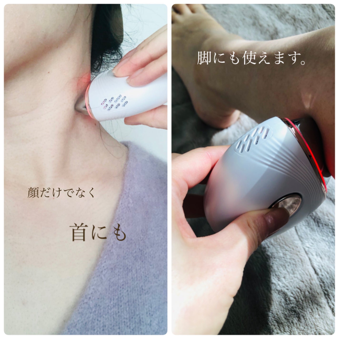 温冷リフトかっさ/ANLAN/美顔器・マッサージを使ったクチコミ(5枚目)