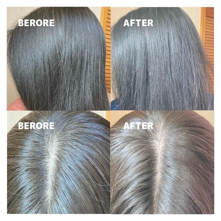 スパークリングスカルプスケーラー/ミンツリー/頭皮ケアを使ったクチコミ(5枚目)