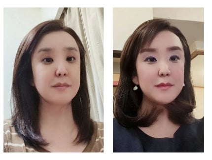 Wアプローチヘアプログラム/MUNOAGE(ミューノアージュ)/頭皮ローションを使ったクチコミ(5枚目)