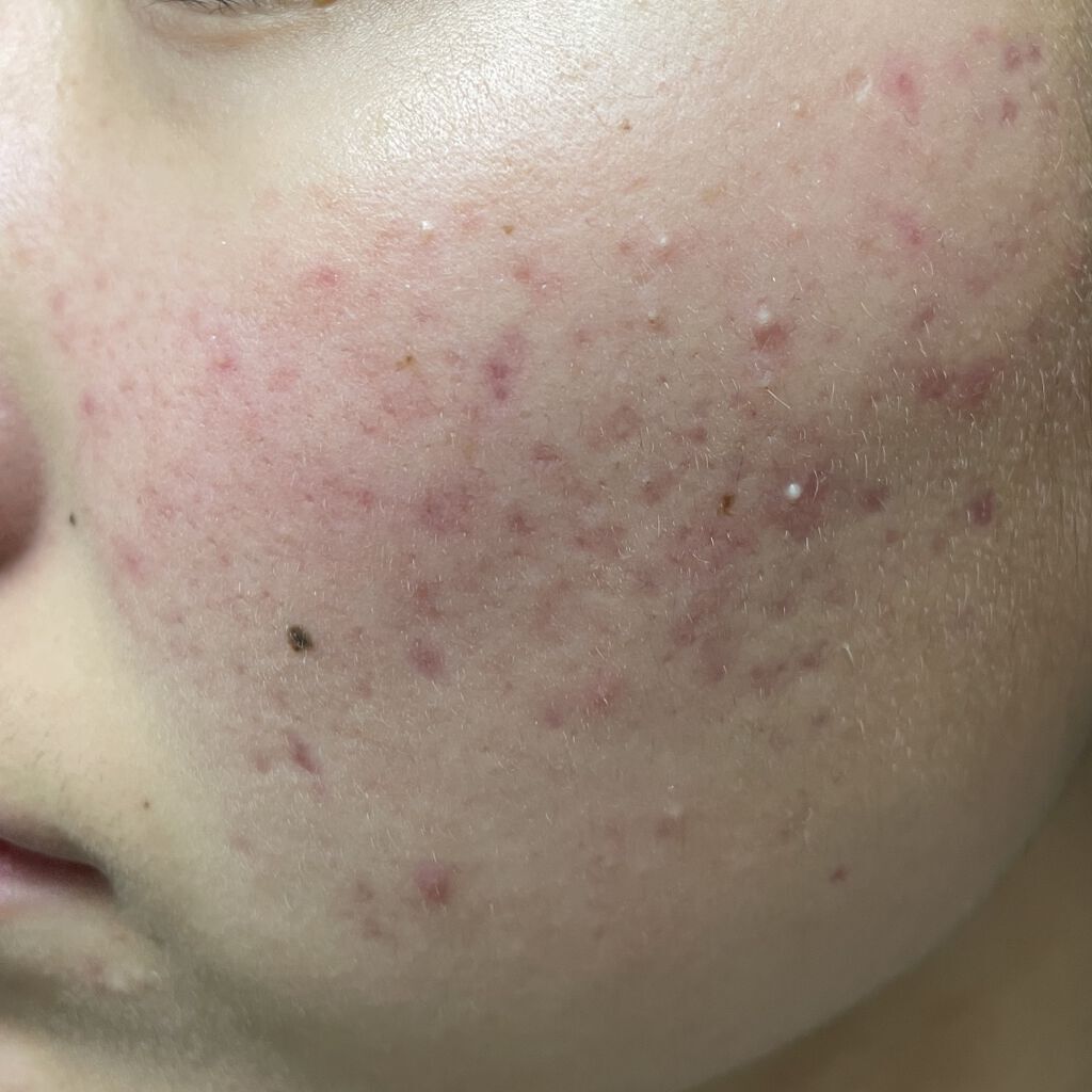 セラキュア センシティブジェリー/CeraLabo/化粧水を使ったクチコミ（2枚目）