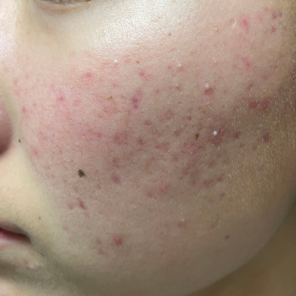 セラキュア センシティブジェリー/CeraLabo/化粧水を使ったクチコミ(2枚目)