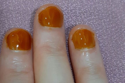 チャームスティックジェル/OMD/オールインワンネイルを使ったクチコミ(2枚目)