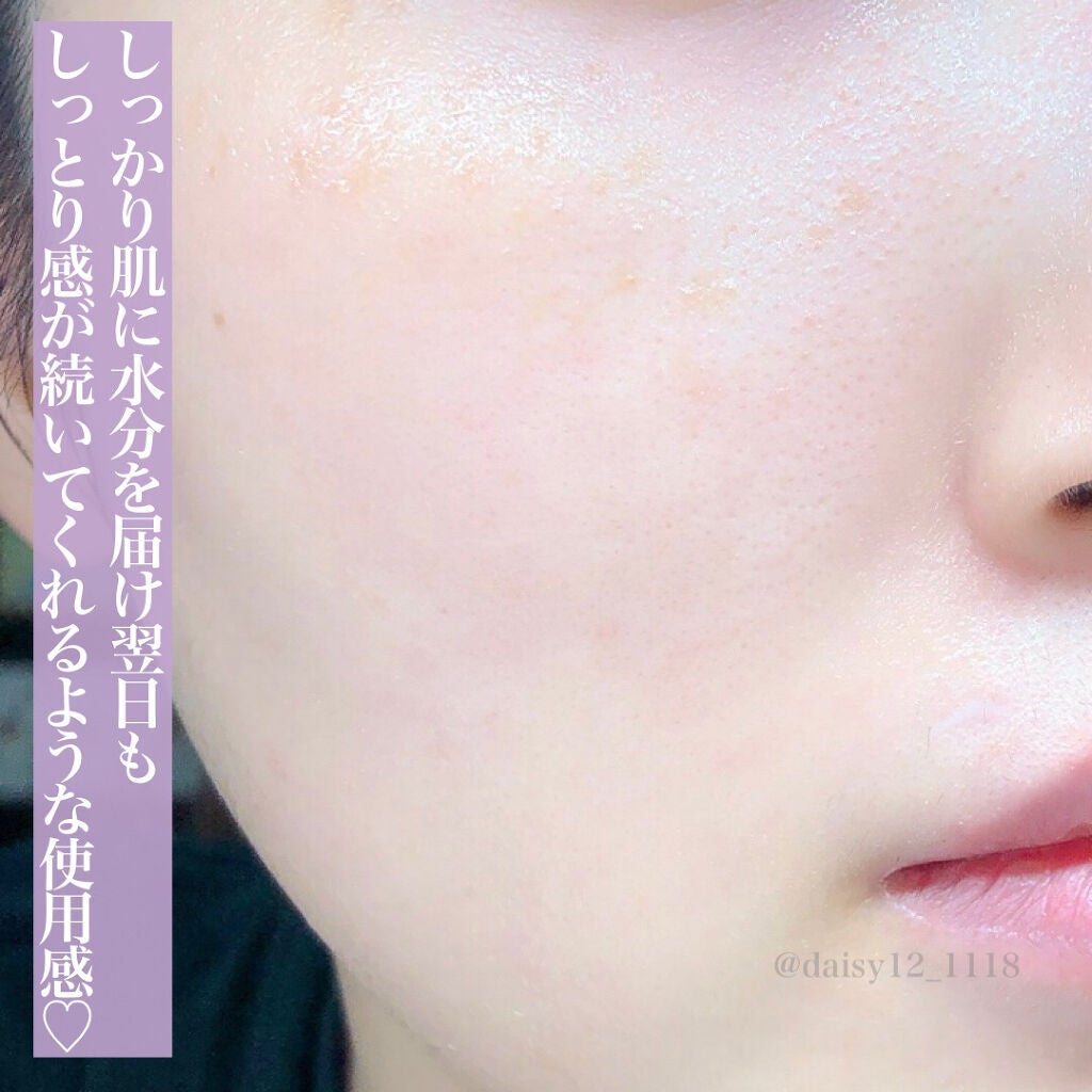 プレミアムトリートメントマスク/SUIKO HATSUCURE/シートマスク・パックを使ったクチコミ(5枚目)