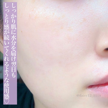 プレミアムトリートメントマスク/SUIKO HATSUCURE/シートマスク・パックを使ったクチコミ(5枚目)