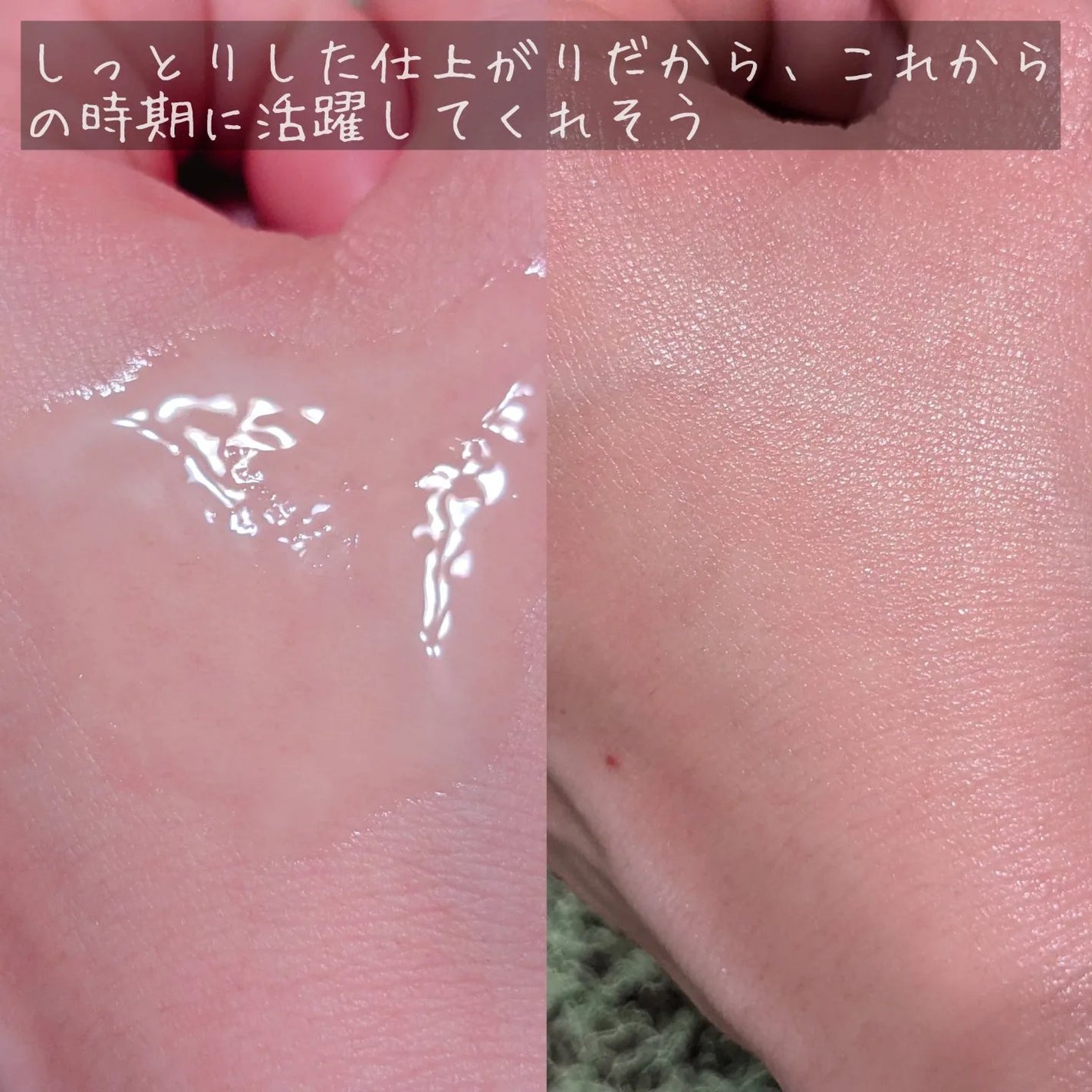 発酵ブラン 美容液 /HAKKOBLANC/美容液を使ったクチコミ(5枚目)