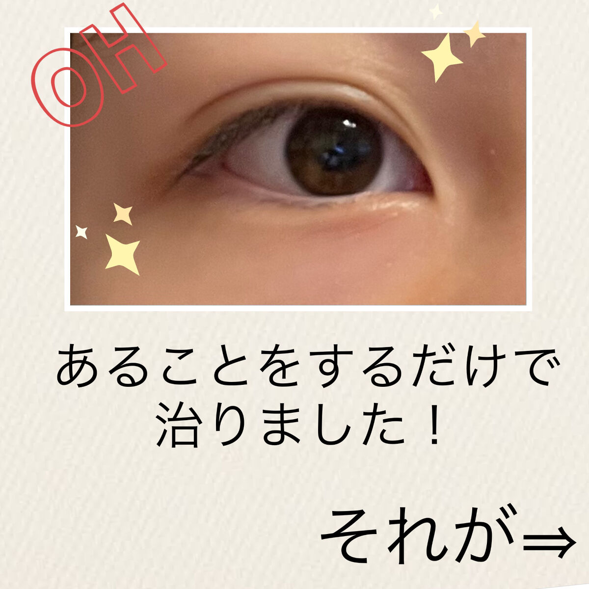 目元ふっくらクリーム NC/なめらか本舗/アイケア・アイクリームを使ったクチコミ（3枚目）