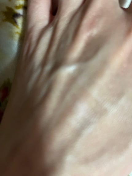 アイクリア カラーベース/Elégance/リキッドコンシーラーを使ったクチコミ(3枚目)