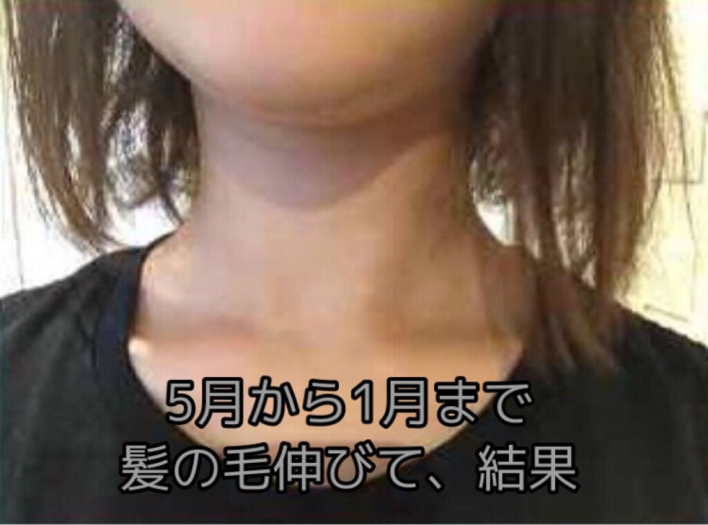 ヘアアクセルレーター レモンライムの香り/加美乃素本舗/頭皮ローションを使ったクチコミ(1枚目)