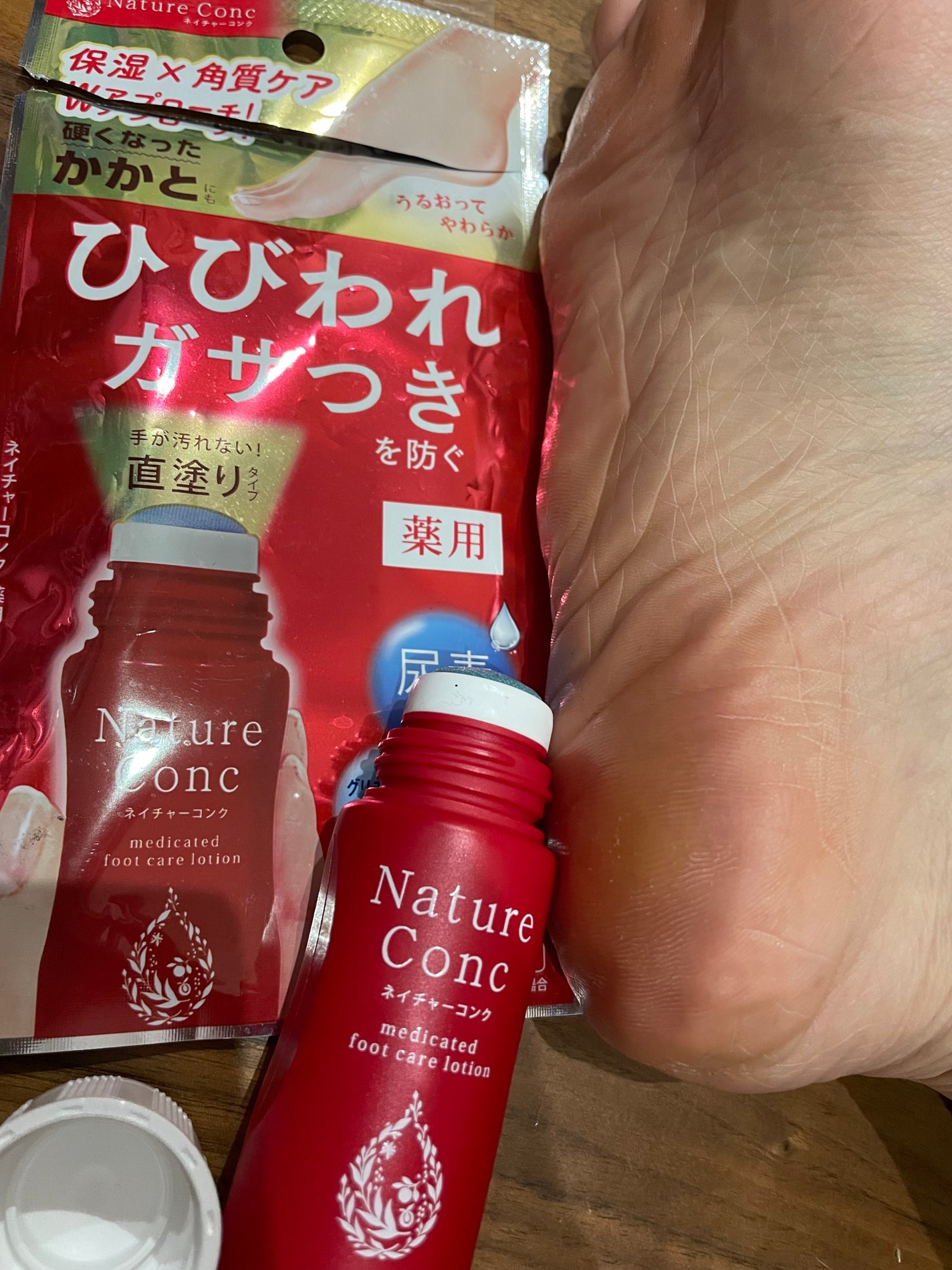 ネイチャーコンク薬用フットケアローション/ネイチャーコンク/レッグ・フットケアを使ったクチコミ(1枚目)