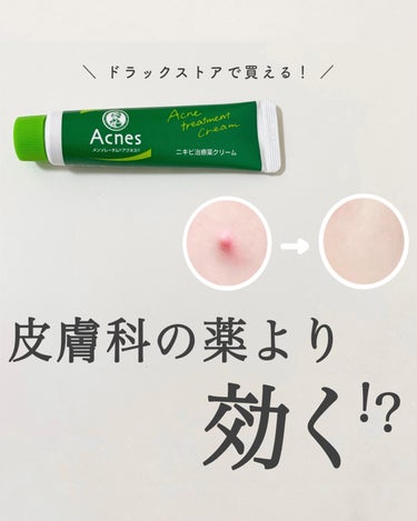 メンソレータム アクネス ニキビ治療薬(医薬品)のクチコミ「【皮膚科の薬より効いた😳！？】市販最強ニキビ薬🤍
⁡
皮膚科のニキビ薬もたくさん試してきました.....」（1枚目）