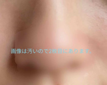 しー∞ on LIPS 「※画像が汚いのでご注意ください。私は昔から鼻の周り、鼻が赤くな..」（1枚目）