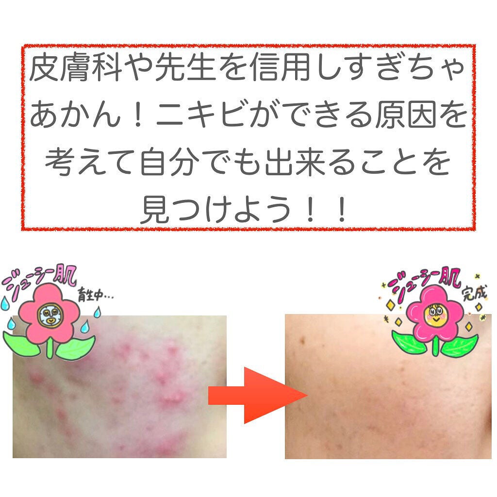 みん on LIPS 「肌荒れしてる方ならば1度は行ったことがあるであろう皮膚科につい..」(9枚目)