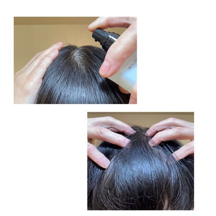 チャップアップ育毛ローション/CHAP UP(チャップアップ)/頭皮ローションを使ったクチコミ(4枚目)