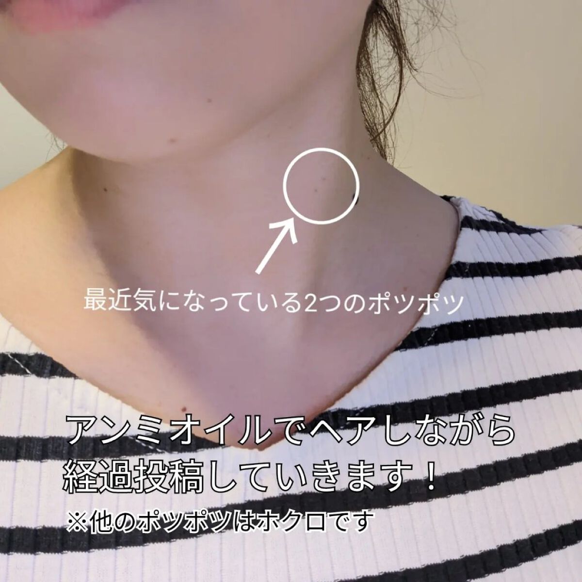 アンミオイル/ジーランドビフー/フェイスオイルを使ったクチコミ（3枚目）