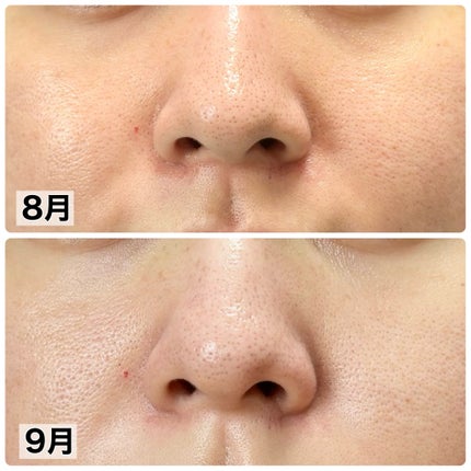 グラマティカル  高濃度美容液 プロテオグリカン原液のクチコミ「\9月の肌記録/
美肌になりたい🥹
☀️朝の洗顔〜スキンケア
・ザ フェイス 泡洗顔料.....」(2枚目)