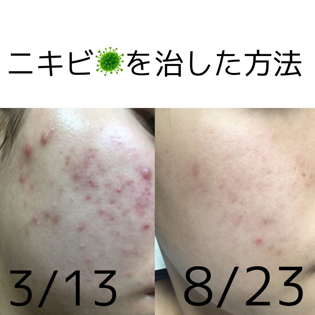 ハトムギ化粧水(ナチュリエ スキンコンディショナー R )/ナチュリエ/化粧水を使ったクチコミ（1枚目）