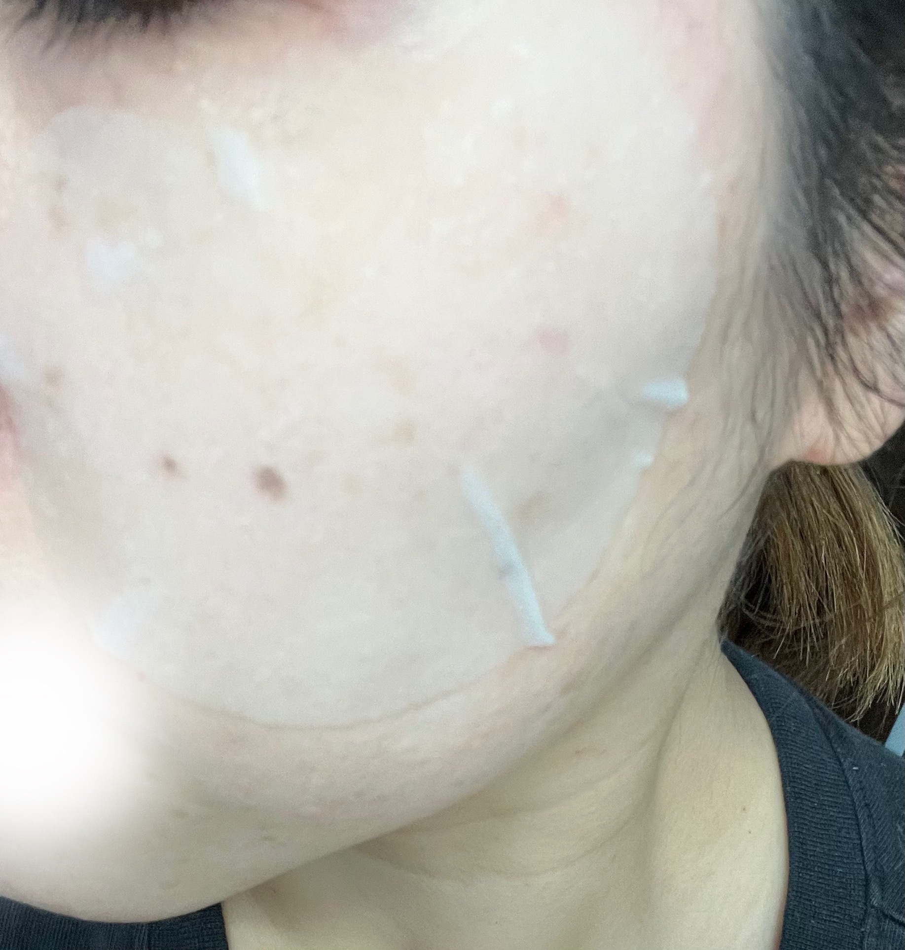 センテラ クイックカーミングパッド/SKIN1004/トナーパッドを使ったクチコミ（3枚目）