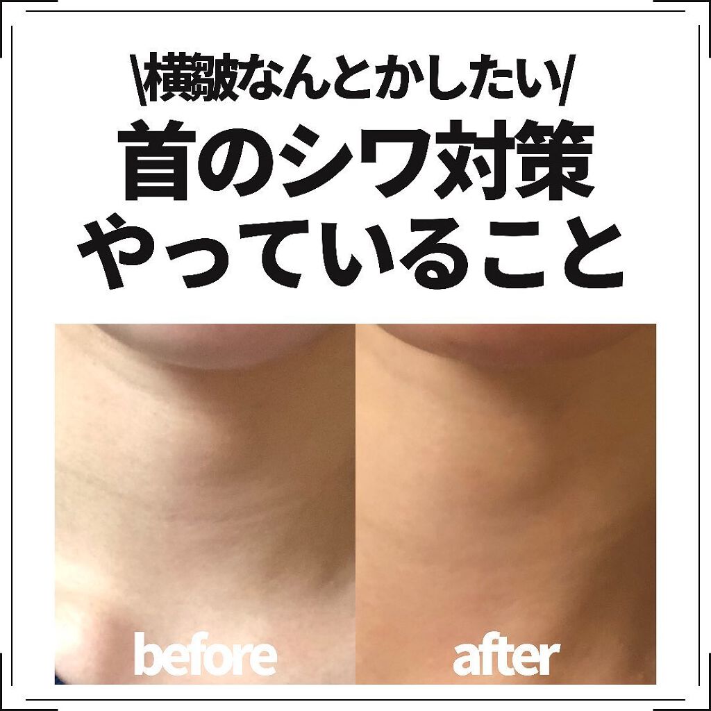 リバイタライジングビタミンAコンプレックス/Sympli Beautiful/美容液を使ったクチコミ（1枚目）