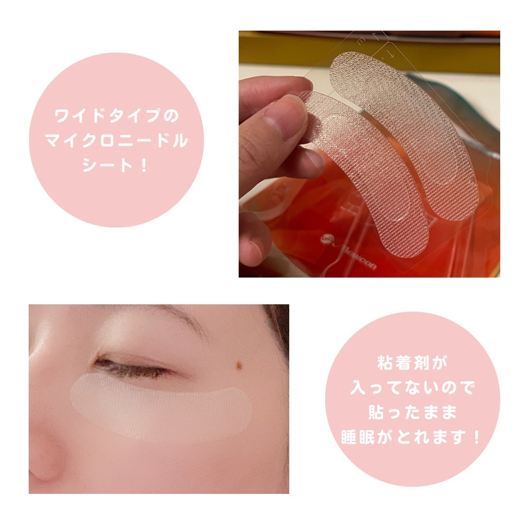 マイクロニードルヒアルロン酸パック 勝負目エステ/メニコン/シートマスク・パックを使ったクチコミ(3枚目)