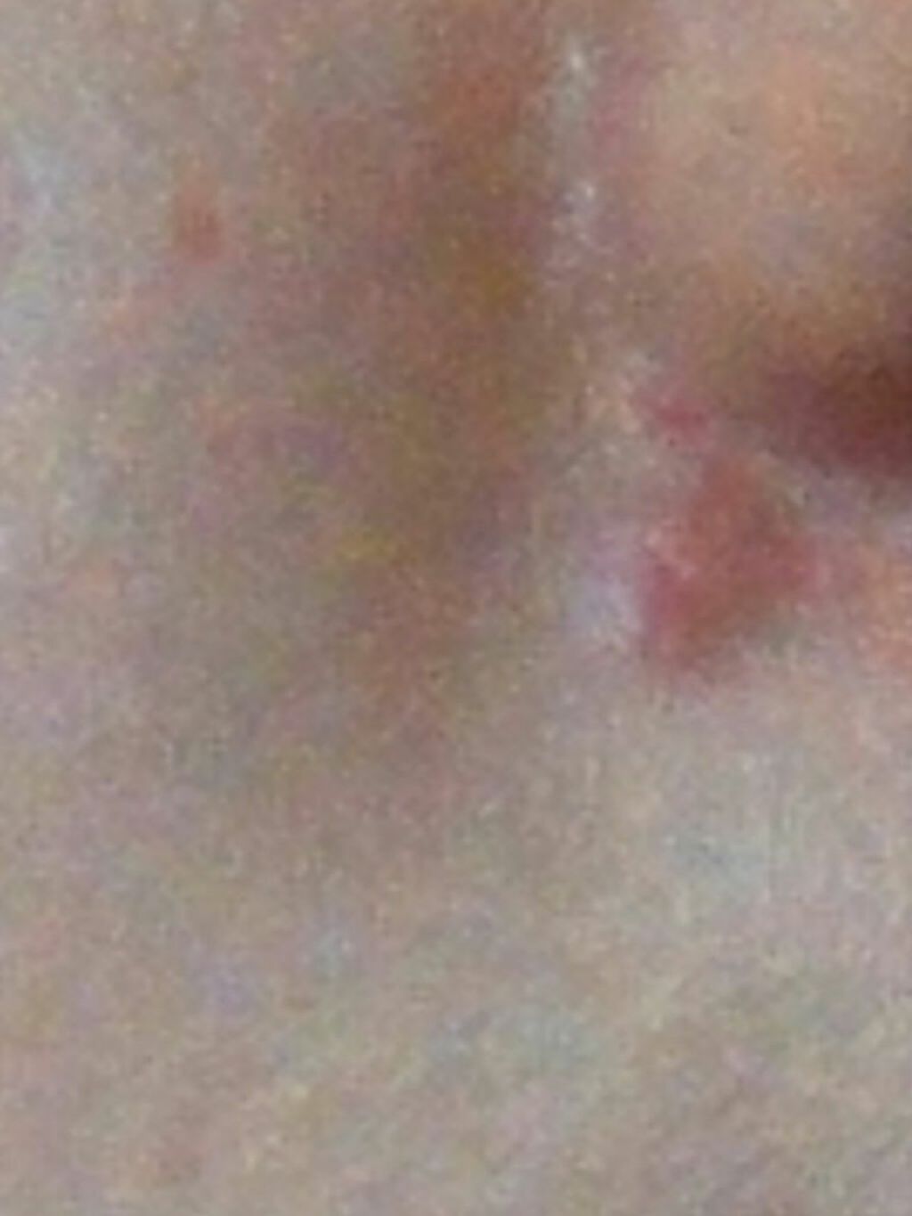 薬用スキンミルク/オードムーゲ/乳液を使ったクチコミ（3枚目）