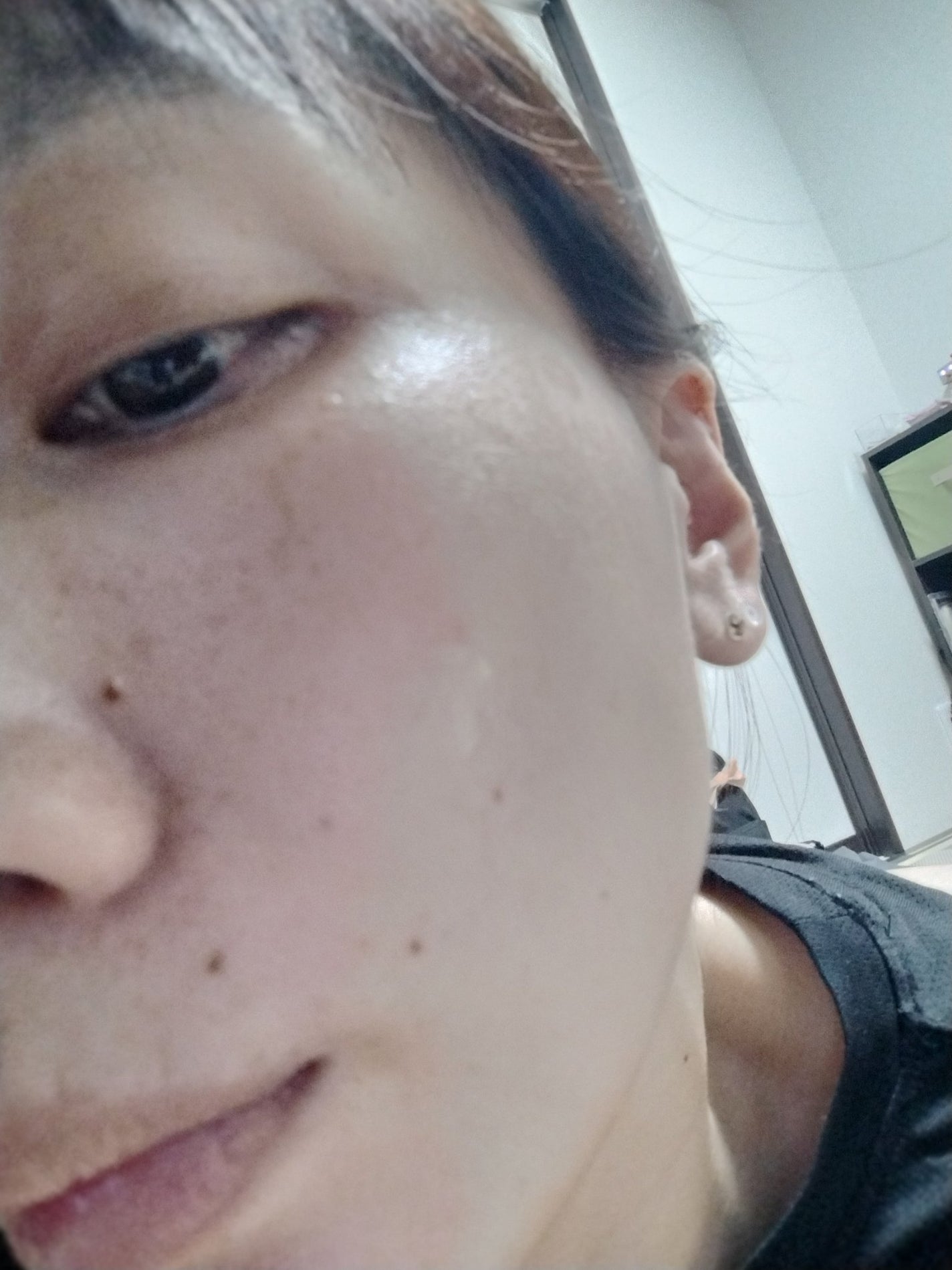 たま on LIPS 「ニキビの跡……とっても気になりますそのままメイクをするのも気が..」(4枚目)