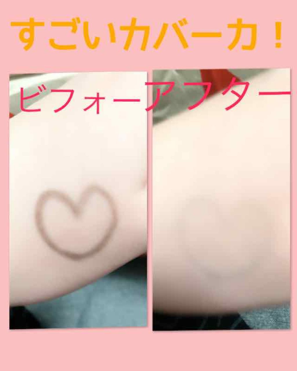 ディオールスキン フォーエヴァー アンダーカバー/Dior/リキッドファンデーションを使ったクチコミ（2枚目）