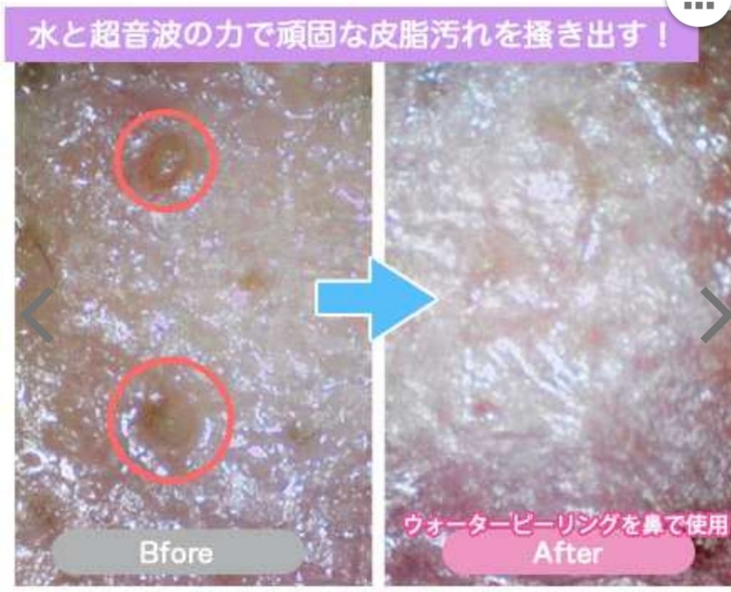 パーフェクトアクアリーボーテ2|Beauteの効果に関する口コミ パーフェクトアクアリーボーテ2|Beauteの効果に関する口コミ