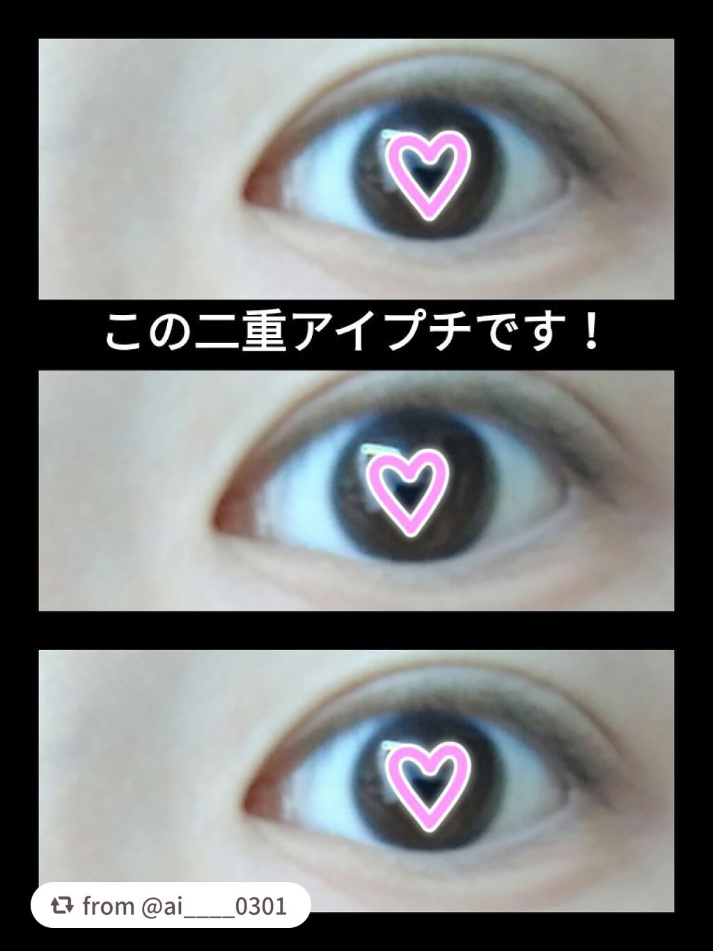 ハイブリッドフィルム/アイトーク/二重まぶた用アイテムを使ったクチコミ(1枚目)