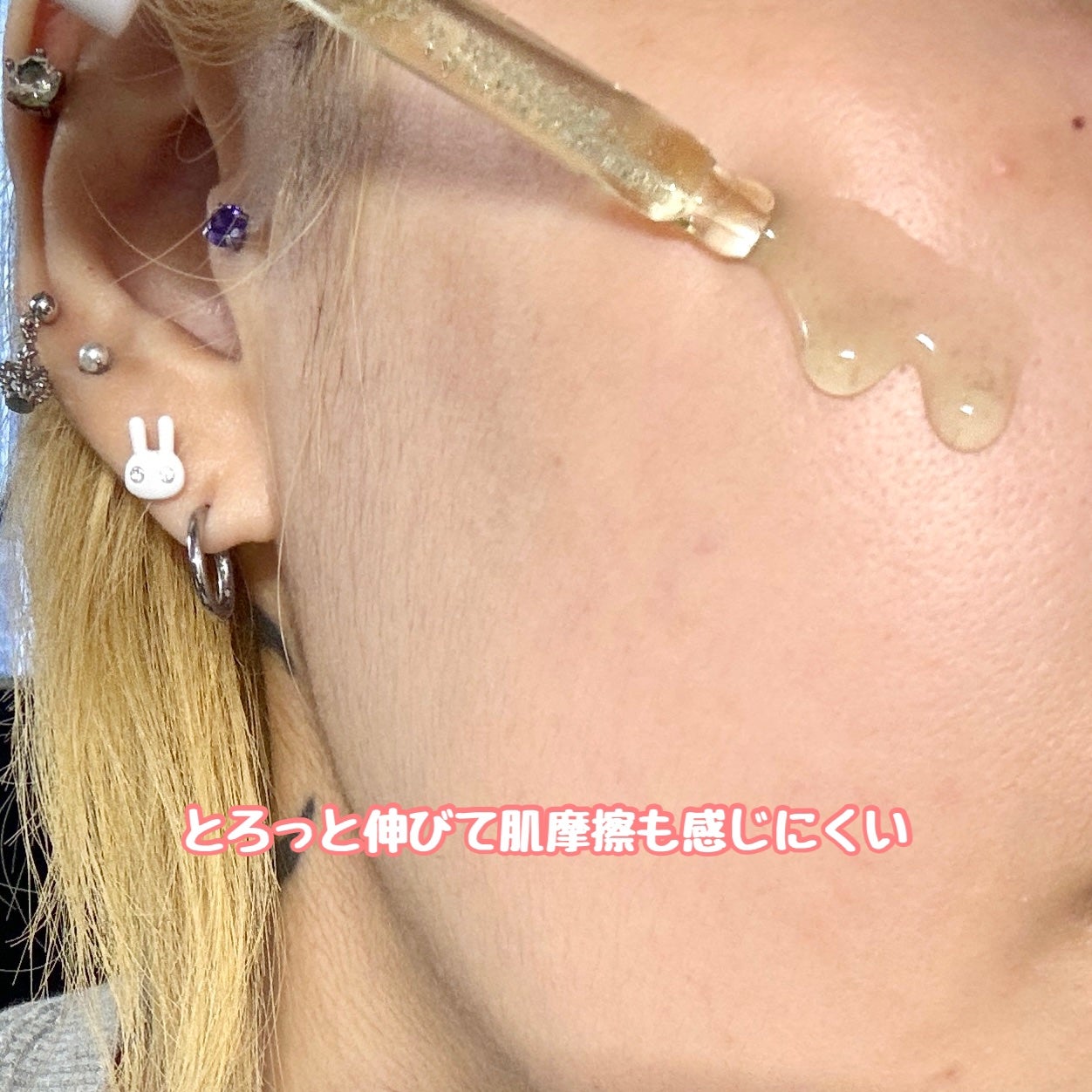 ぼぶ on LIPS 「#PR@medicube_japanたっぷりのシカ成分でニキビ..」(3枚目)