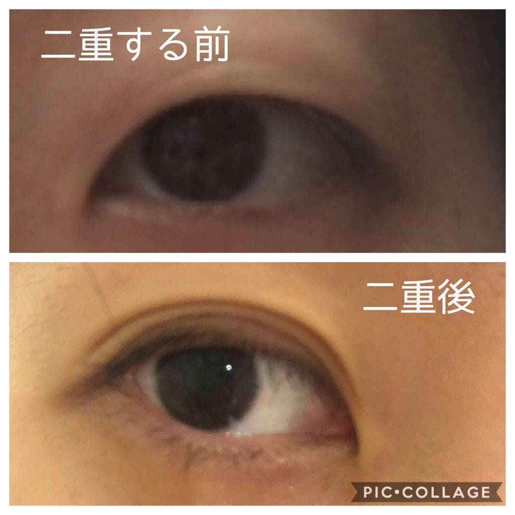 みるく on LIPS 「今回は、、、私が二重にしたことを書こうと思います。と言ってもだ..」(2枚目)