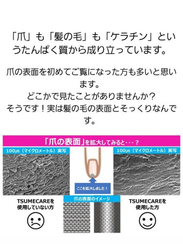 TSUMECARE/NailSalon mayunail/ネイルオイル・トリートメントを使ったクチコミ（2枚目）