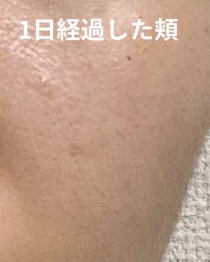 ウルトラ ブラーリング セラム プライマー/saat insight/化粧下地を使ったクチコミ(3枚目)